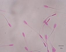 NDRI-ss-02
